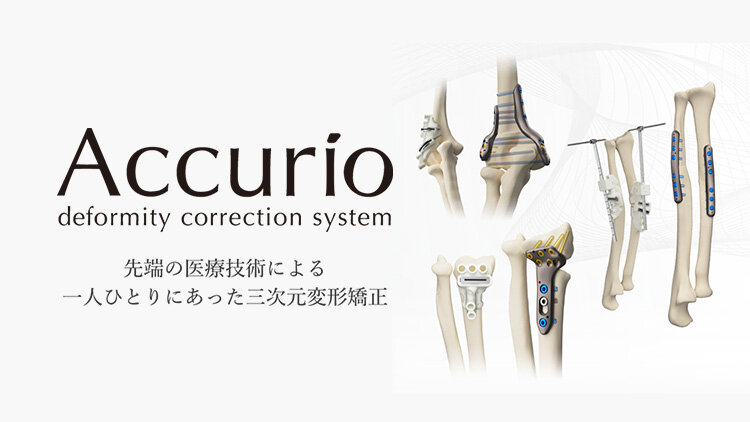 Accurio deformity correction system 先端の医療技術による一人ひとりにあった三次元変形矯正